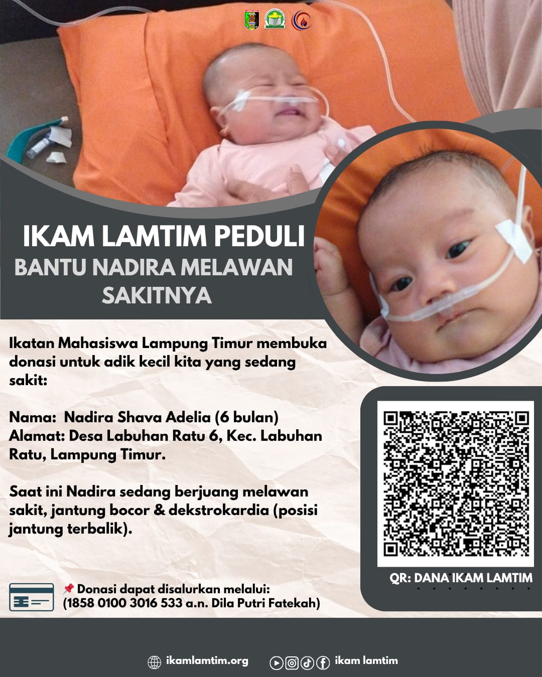 Kepedulian mahasiswa (IKAM) ikatan mahasiswa Lampung timur Donasi tertuju ke salah satu balita di lamtim